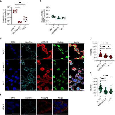 Tumor cells express and maintain HMGB1 in the reduced isoform to enhance CXCR4-mediated migration